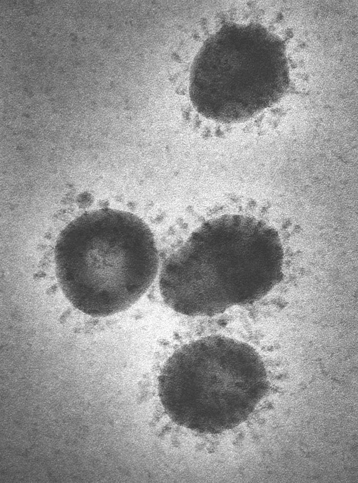 Coronaviruses, Electron Micrograph